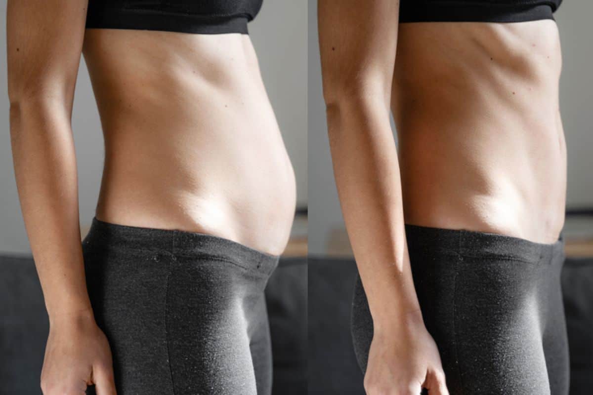 Post-Pregnancy: What Happens to Your Abdominal Muscles After Birth Fleet