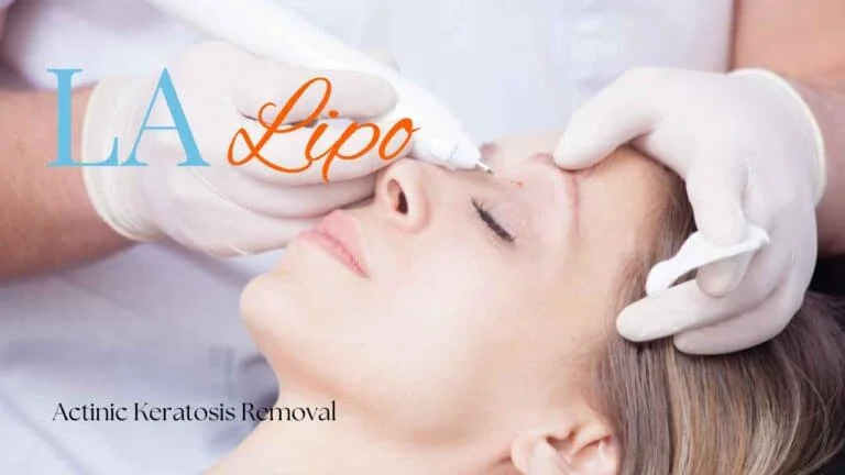 Woman receiving Actinic Keratosis Removal Treatment Fleet