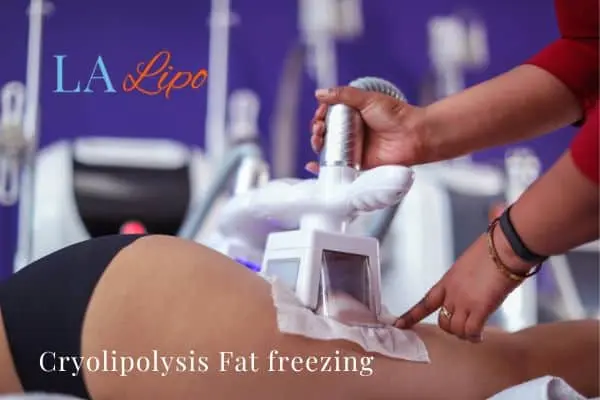 women getting fat freezing Fleet