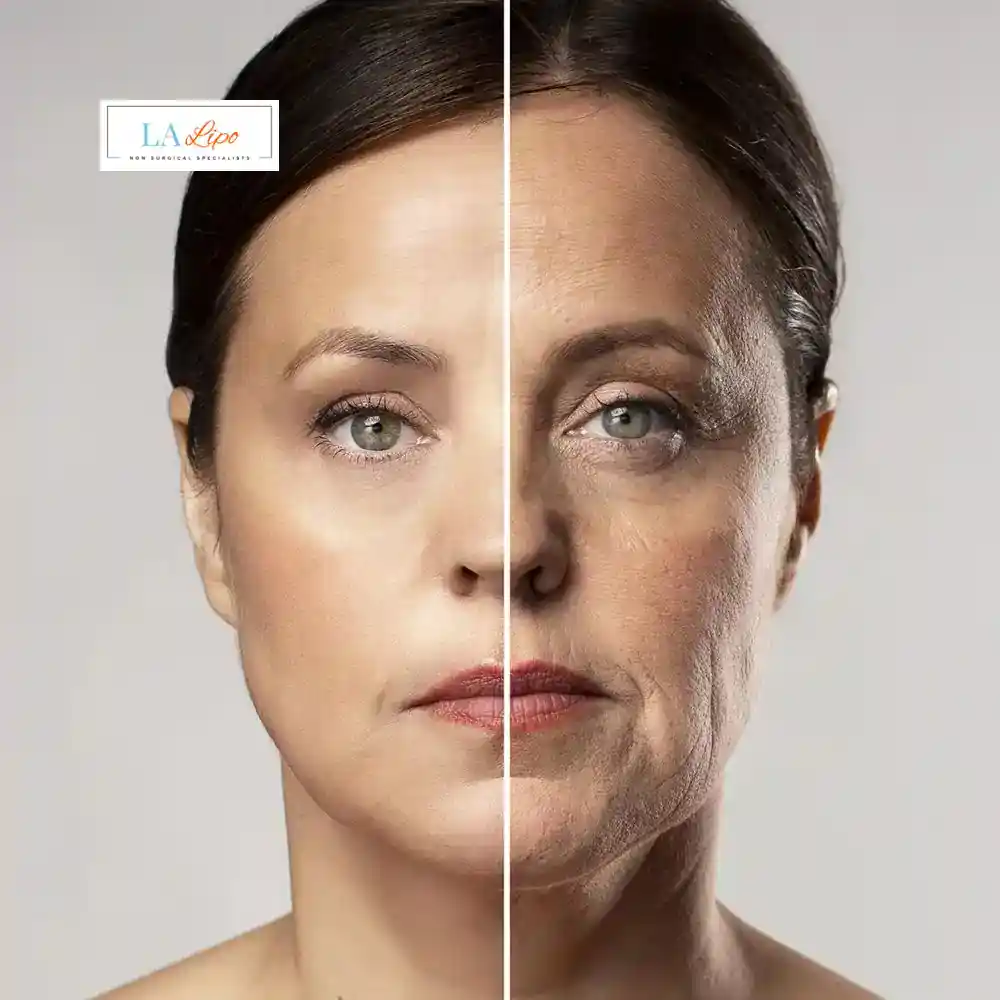 How Can You Tell If Non-Surgical Skin Tightening Is Right for You Fleet?