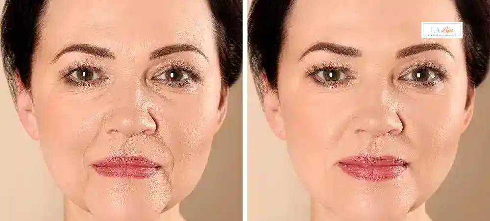 Why Aren’t My Skincare Products Making My Sagging Skin Look Firmer Fleet?