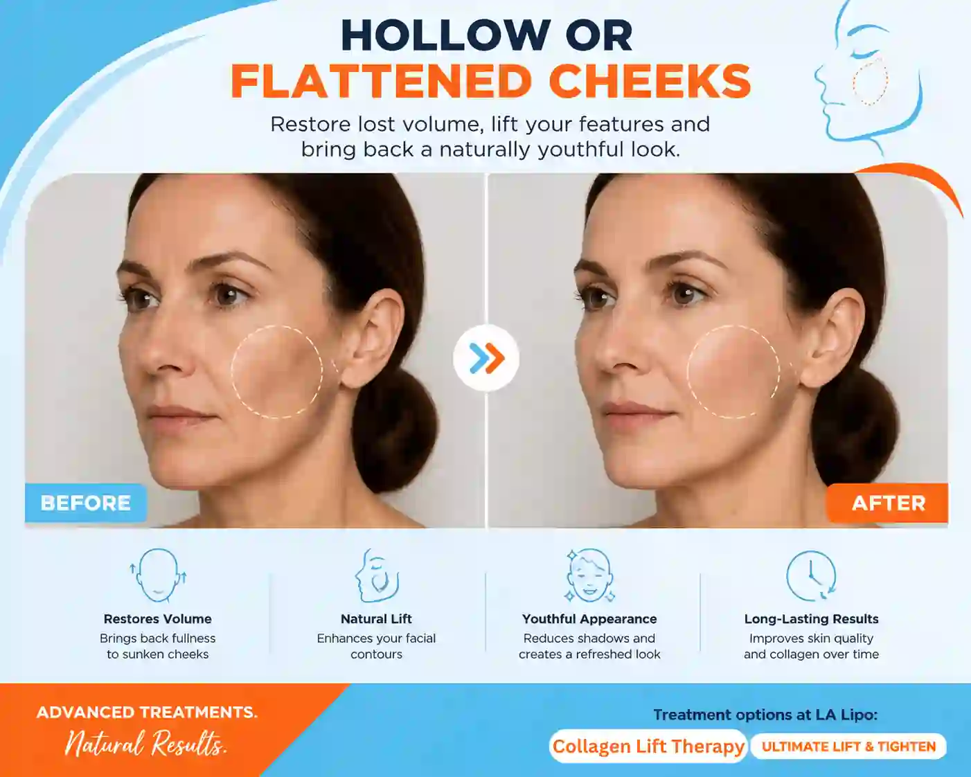 Sign #4: Hollow or Flattened Cheeks Fleet