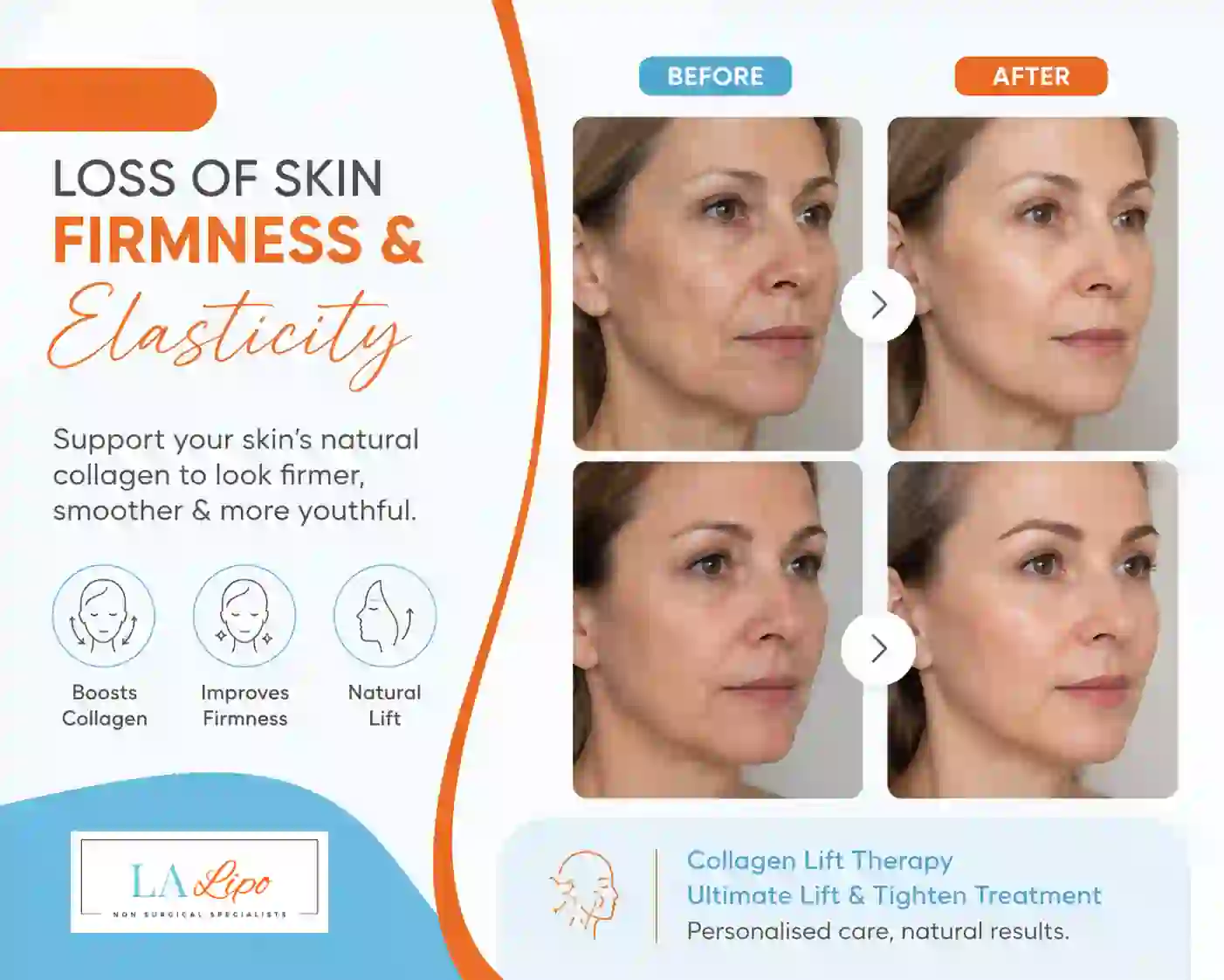 Sign #7: Loss of Skin Firmness and Elasticity Fleet